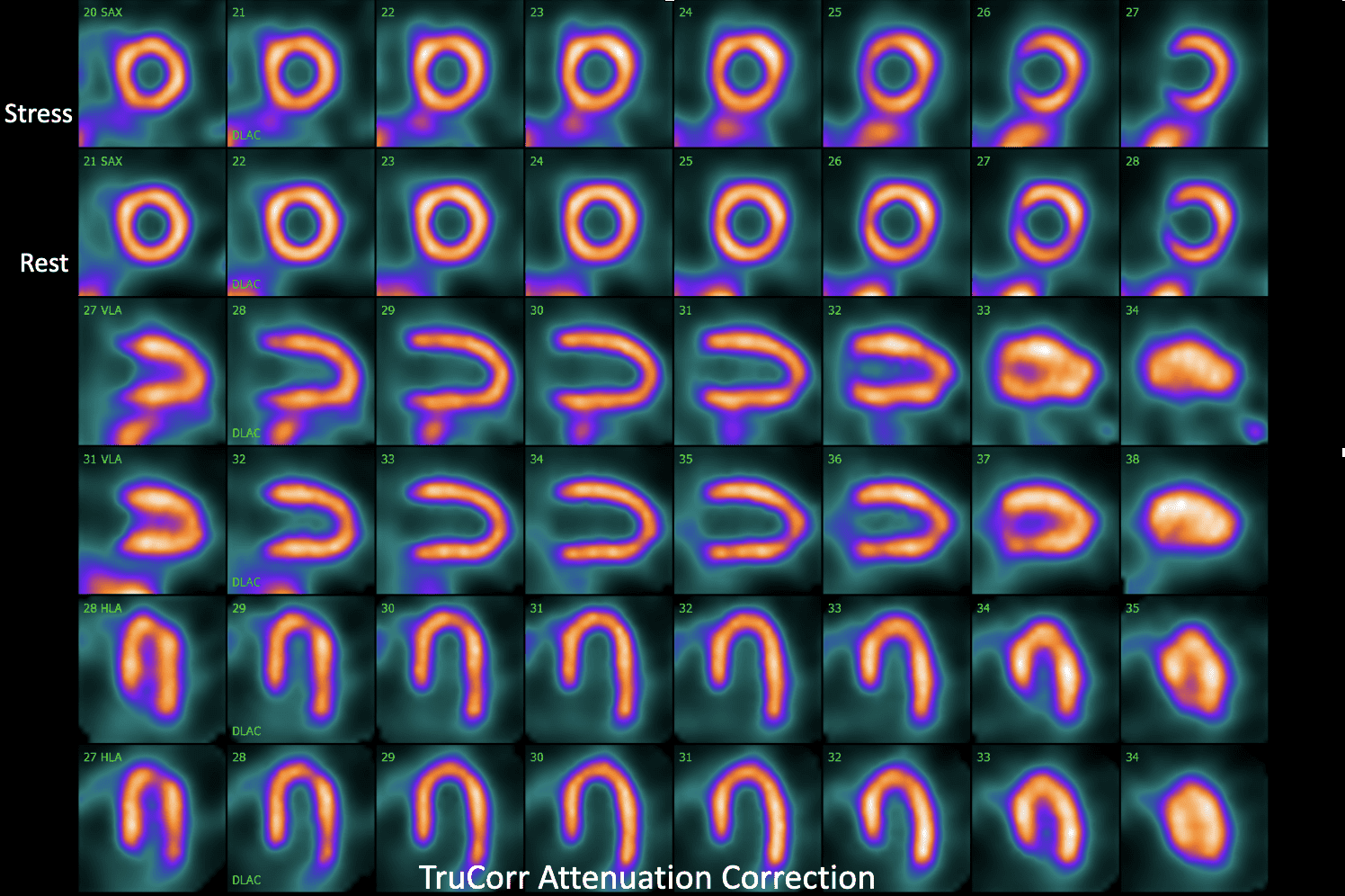 corrected_03