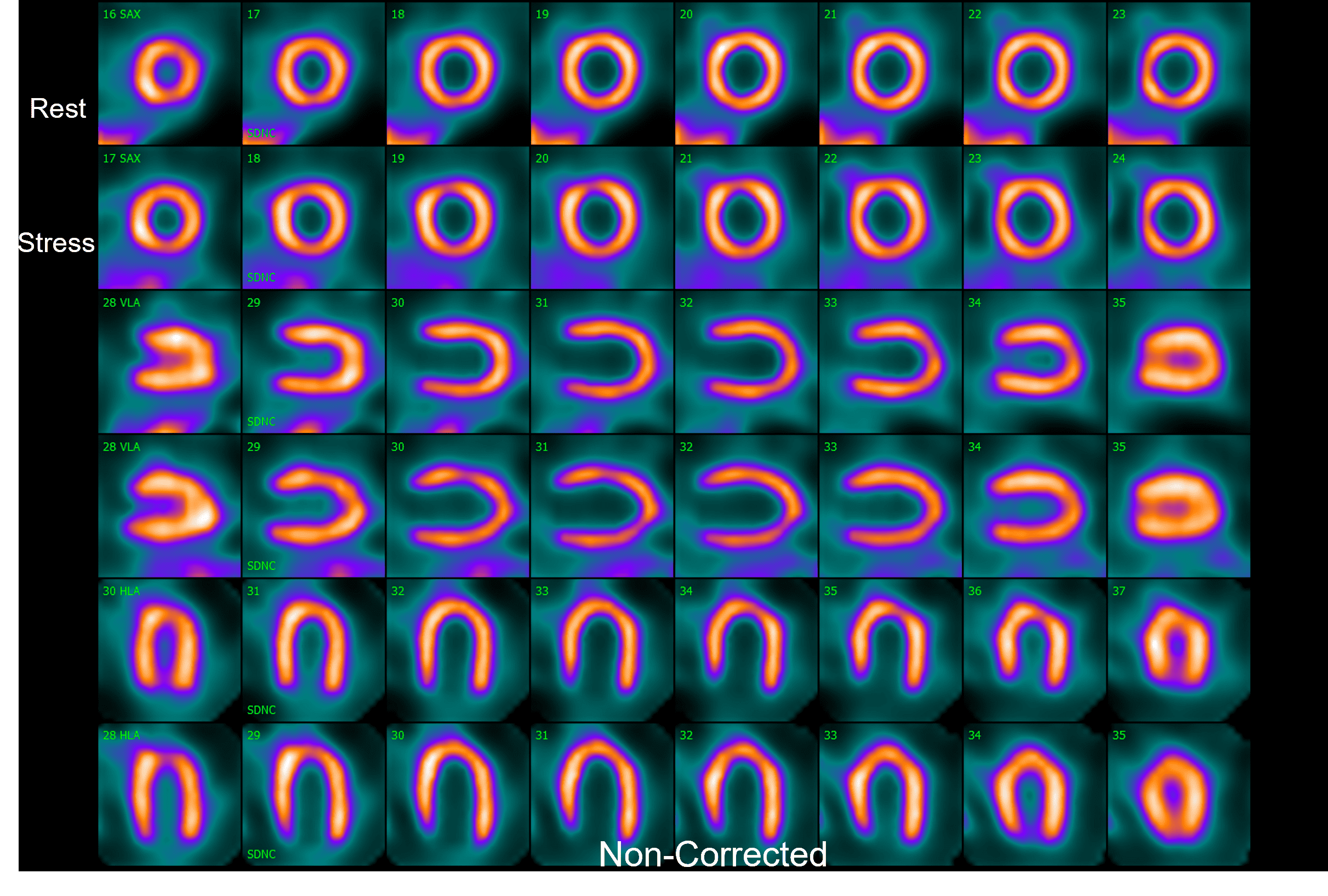 Non-corrected 2