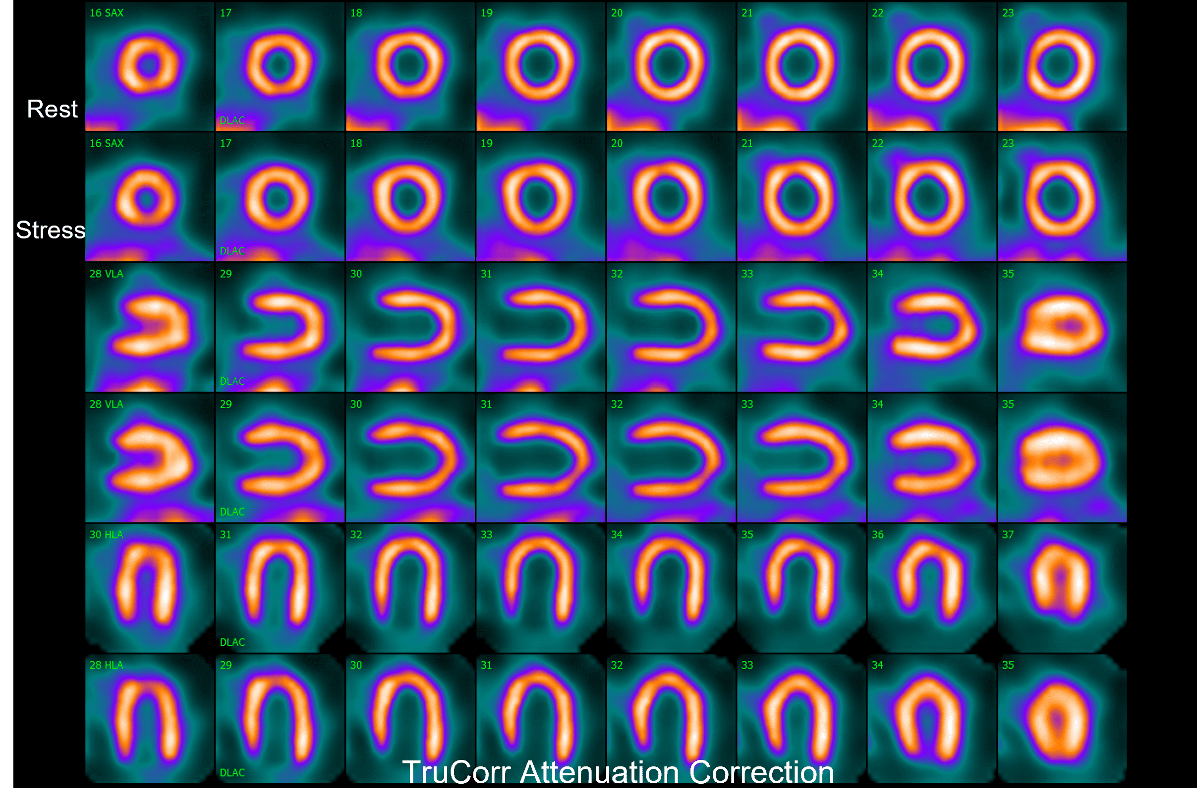Trucorr 2